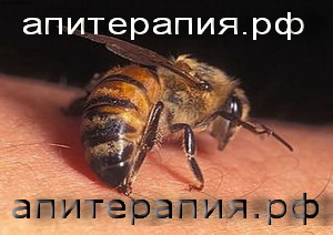 http://www.апитерапия.рф/images/apit8.jpg